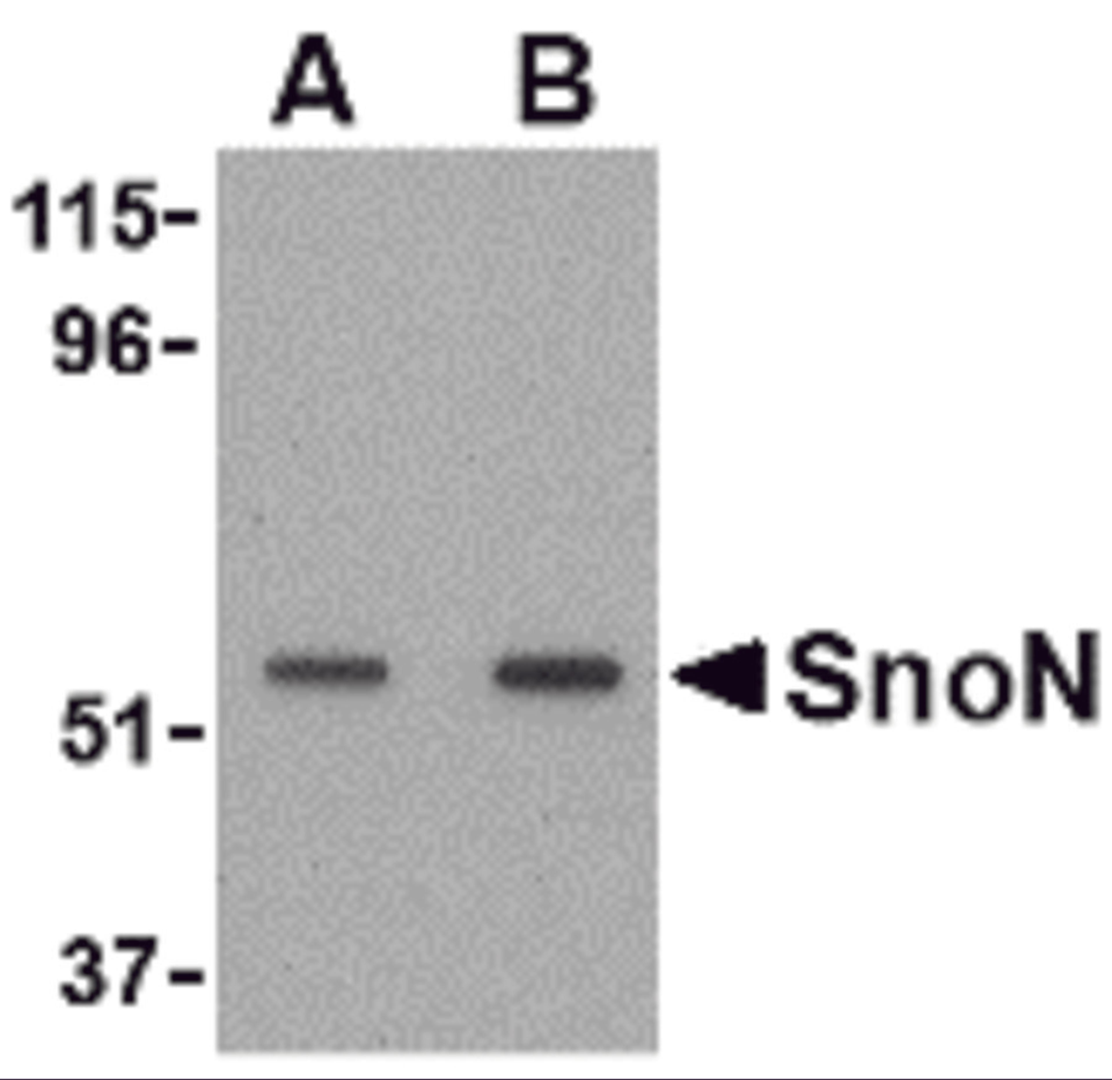 Western blot analysis of SnoN in A431 cell lysate with SnoN antibody at (A) 0.5 and (B) 1 &#956;g/mL. 