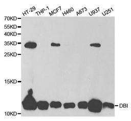 Western blot analysis of extracts of various cell lines using DBI antibody