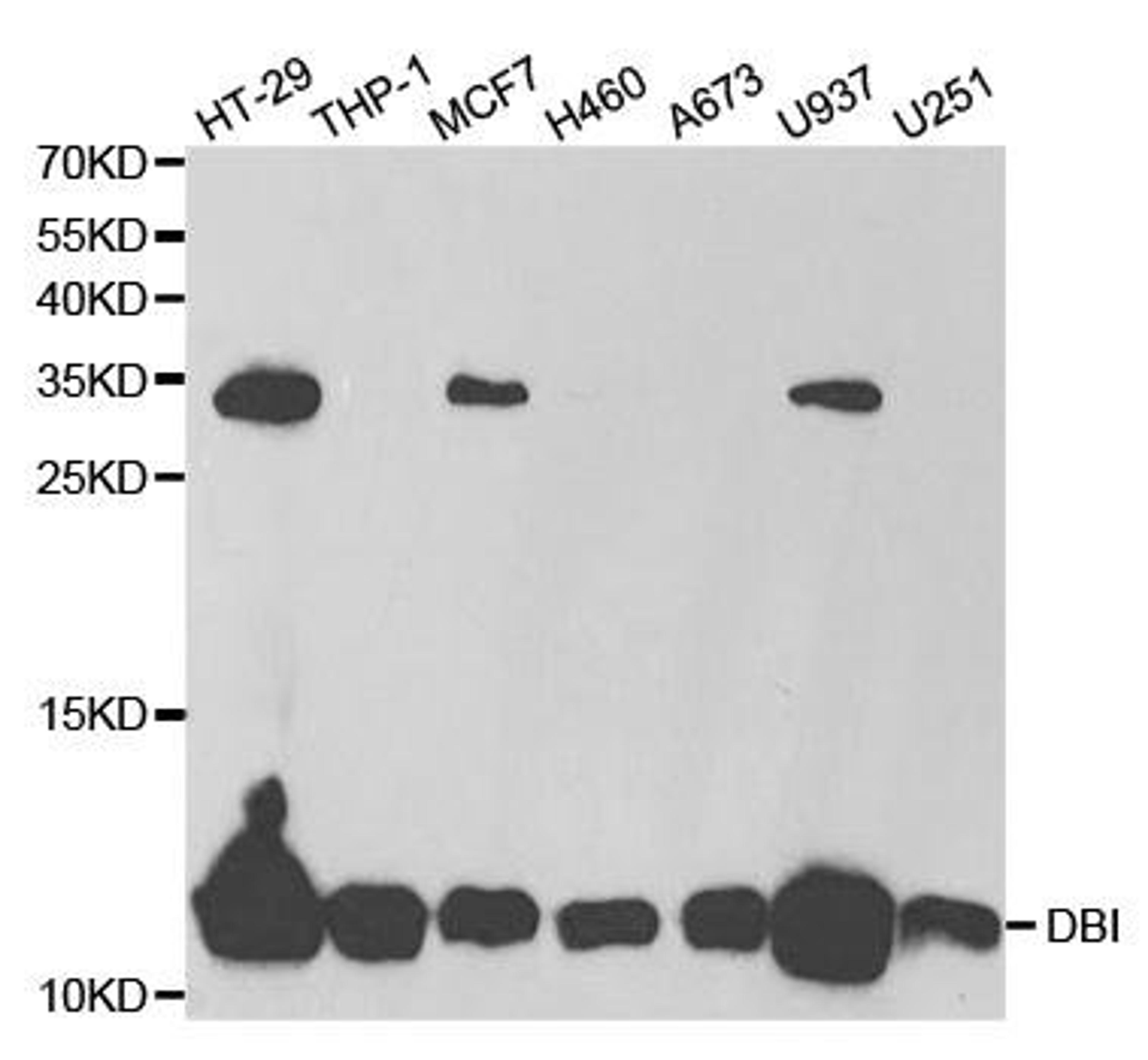 Western blot analysis of extracts of various cell lines using DBI antibody