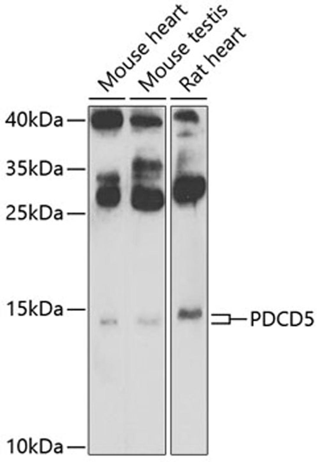 Western blot - PDCD5 Antibody (A7298)