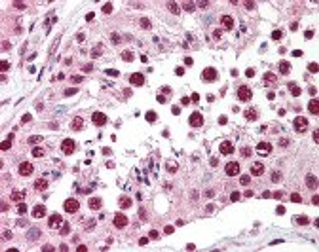 Immunohistochemistry staining of SPANXC in testis tissue using SPANXC Antibody.