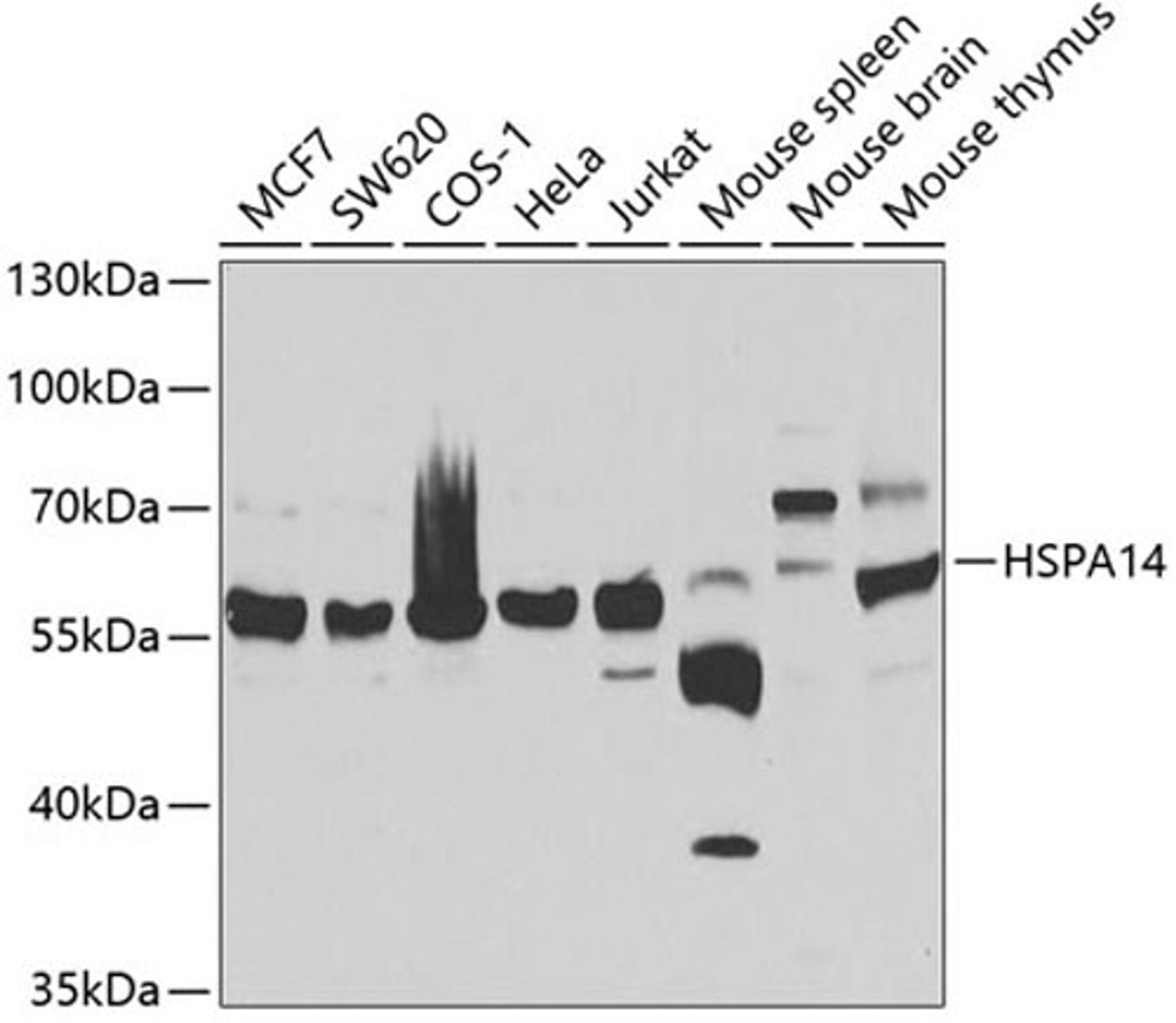 Western blot - HSPA14 antibody (A7107)