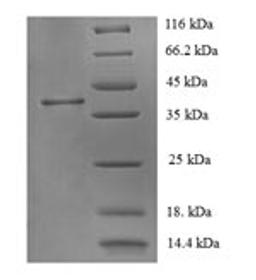 (Tris-Glycine gel) Discontinuous SDS-PAGE (reduced) with 5% enrichment gel and 15% separation gel.