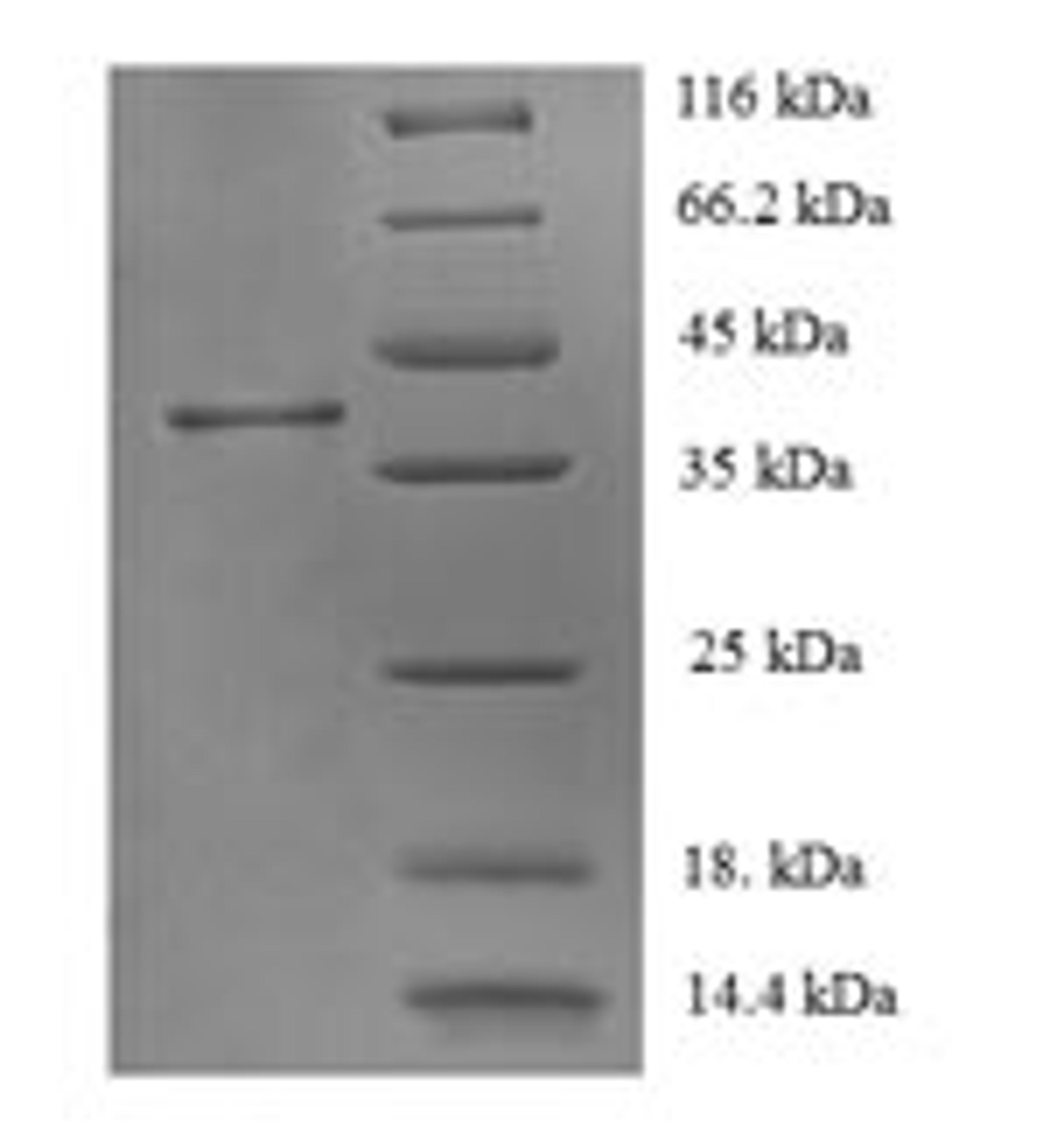 (Tris-Glycine gel) Discontinuous SDS-PAGE (reduced) with 5% enrichment gel and 15% separation gel.