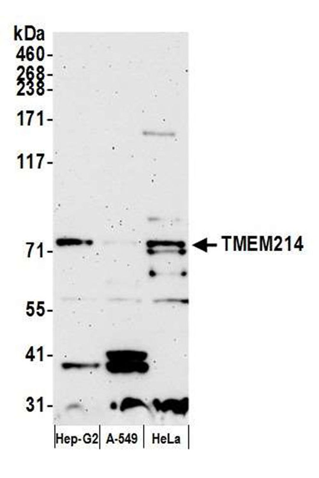 Detection of human TMEM214 by WB.