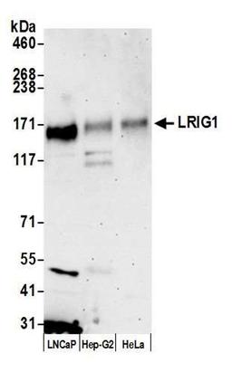 Detection of human LRIG1 by WB.