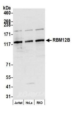 Detection of human RBM12B by WB.