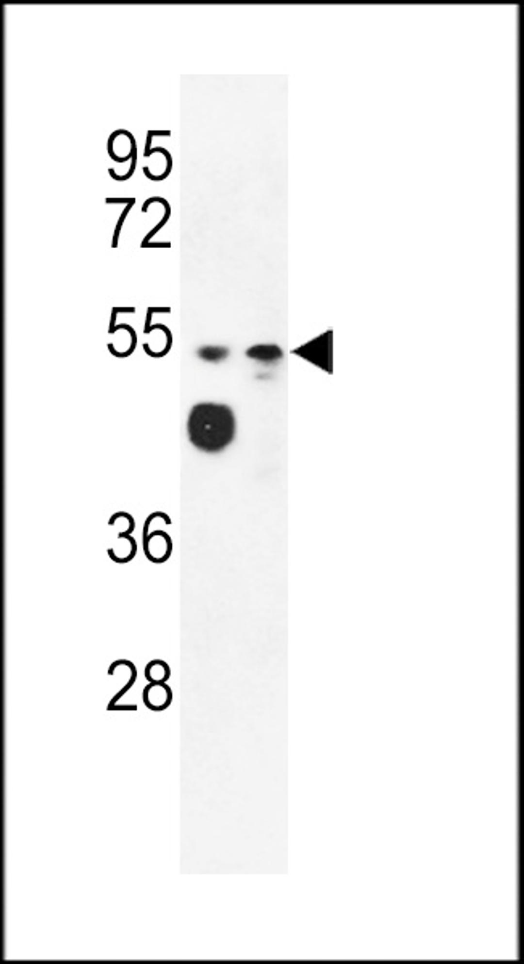 Western blot analysis of MALD2 Antibody in WiDr, MDA-MB231 cell line lysates (35ug/lane)