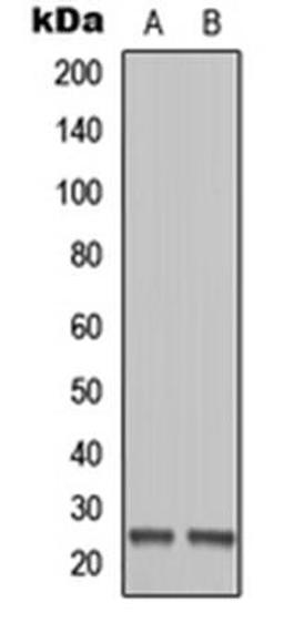 Western blot analysis of Ramos (Lane1), HEK293T (Lane2) whole cell using MOB1B antibody