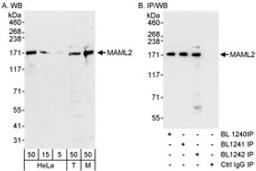 Detection of human and mouse MAML2 by western blot (h and m) and immunoprecipitation (m).