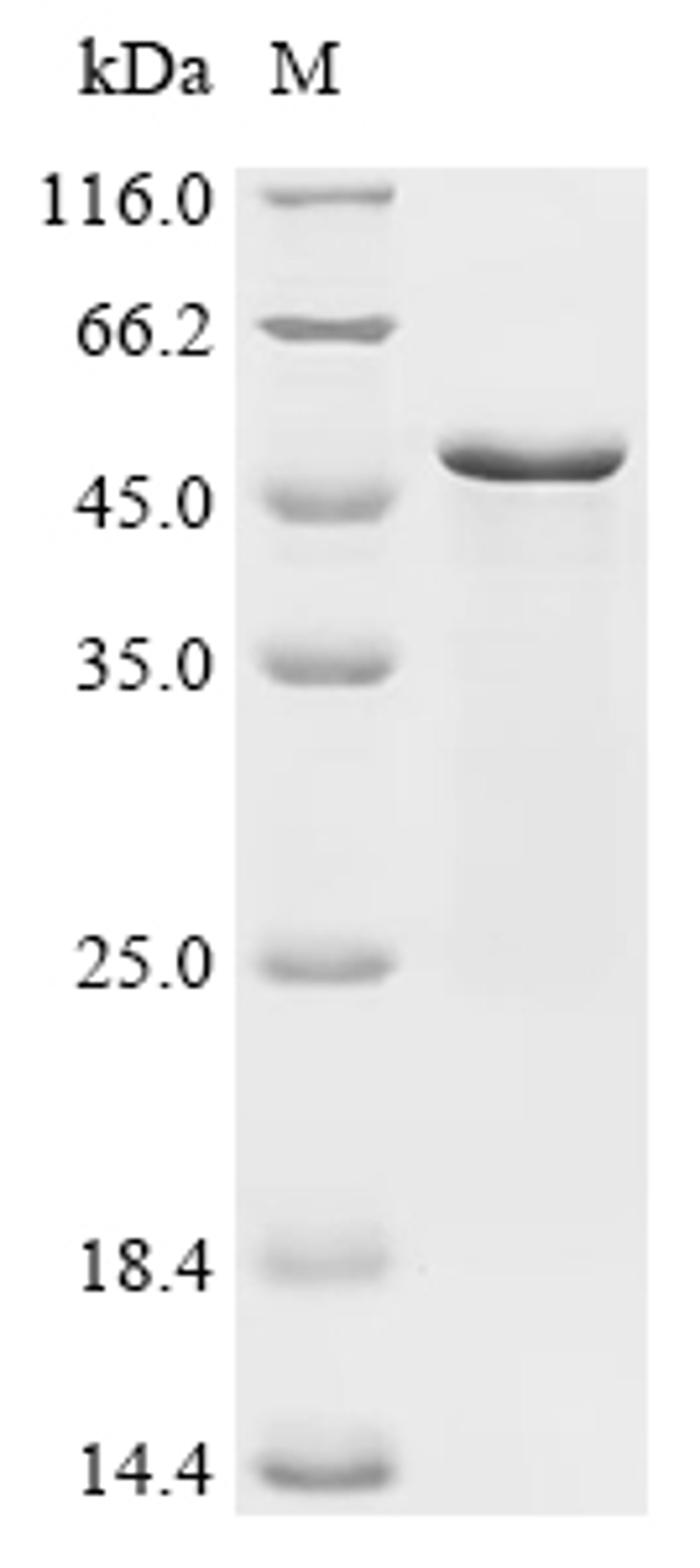 (Tris-Glycine gel) Discontinuous SDS-PAGE (reduced) with 5% enrichment gel and 15% separation gel.