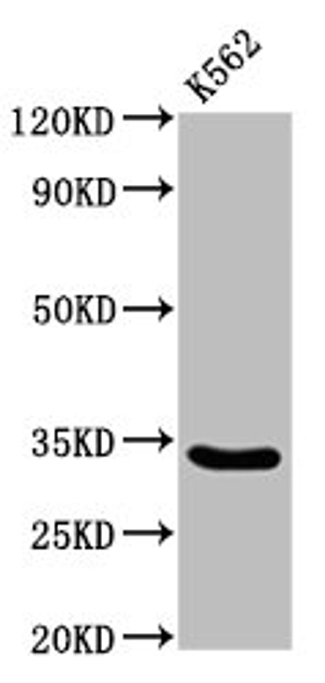 Western Blot. Positive WB detected in: K562 whole cell lysate. All lanes: PEX26 antibody at 3.4µg/ml. Secondary. Goat polyclonal to rabbit IgG at 1/50000 dilution. Predicted band size: 34, 29 kDa. Observed band size: 34 kDa