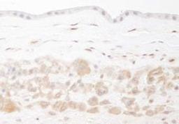 Detection of human PBEF by immunohistochemistry.