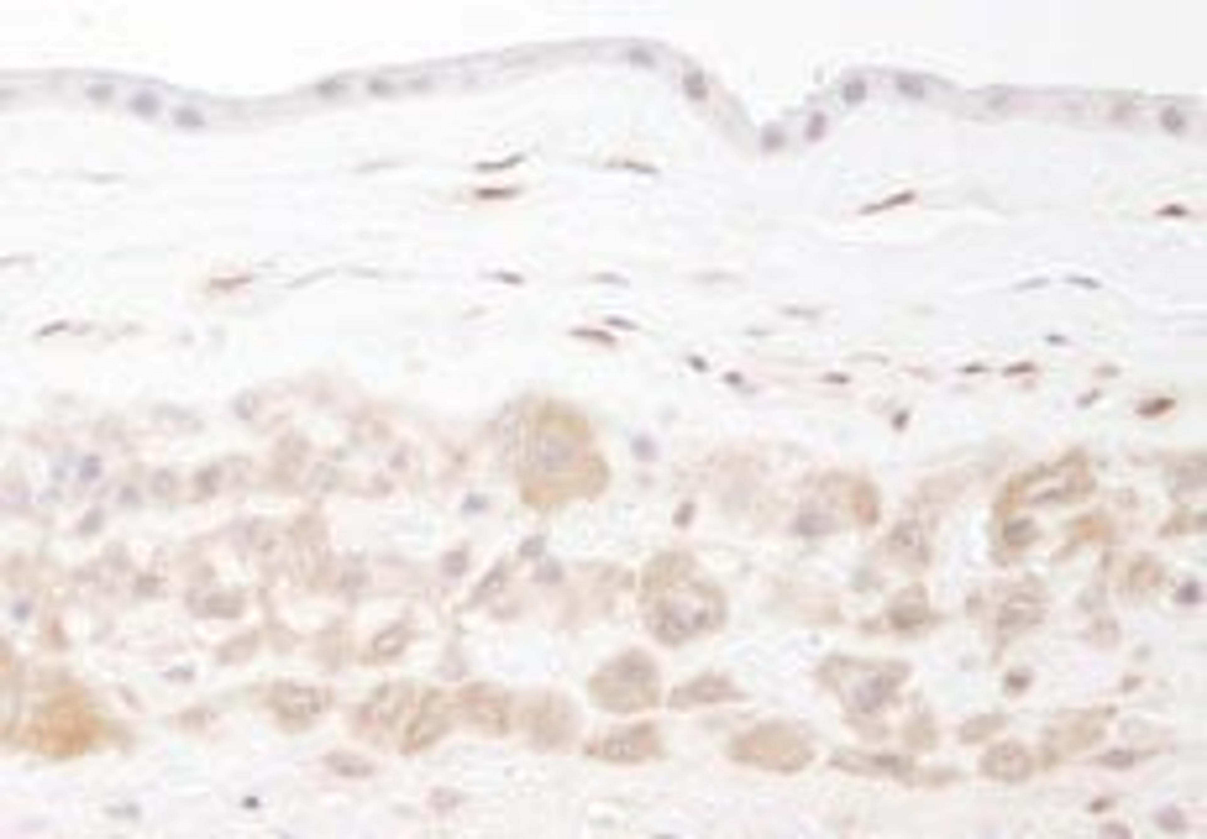 Detection of human PBEF by immunohistochemistry.