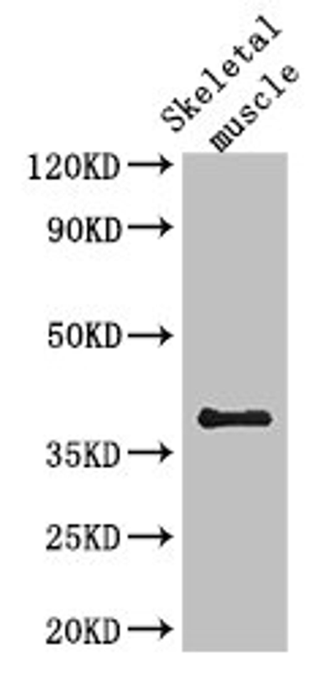 Western Blot. Positive WB detected in: Mouse skeletal muscle tissue. All lanes: KIR2DL3 antibody at 2.7ug/ml. Secondary. Goat polyclonal to rabbit IgG at 1/50000 dilution. Predicted band size: 51, 59 kDa. Observed band size: 38 kDa. 