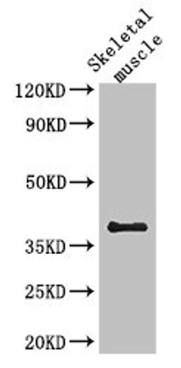 Western Blot. Positive WB detected in: Mouse skeletal muscle tissue. All lanes: KIR2DL3 antibody at 2.7ug/ml. Secondary. Goat polyclonal to rabbit IgG at 1/50000 dilution. Predicted band size: 51, 59 kDa. Observed band size: 38 kDa.