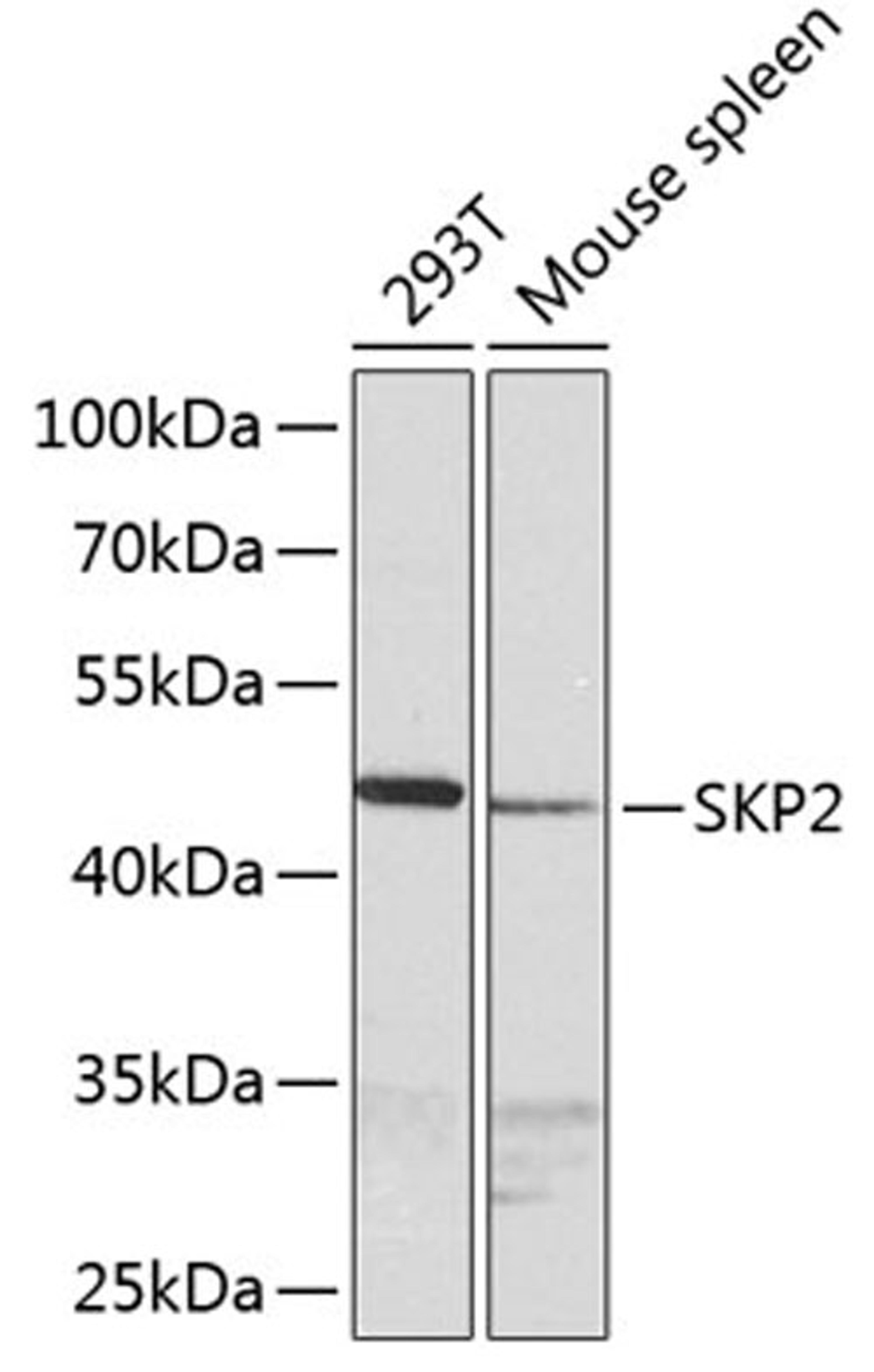 Western blot - SKP2 antibody (A0842)