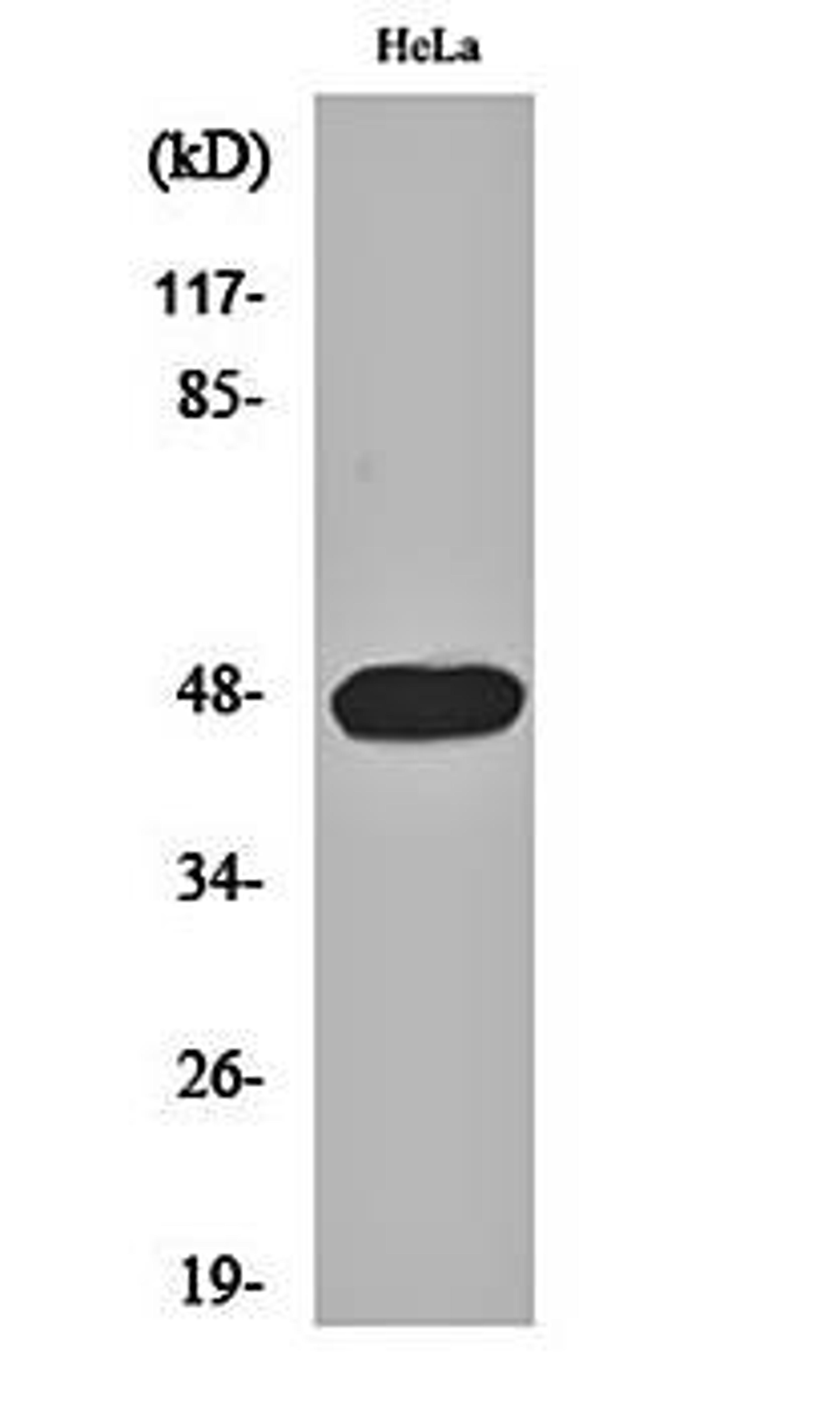 Western blot analysis of Hela cell lysates using Cyclin E1 (phospho-T395) antibody