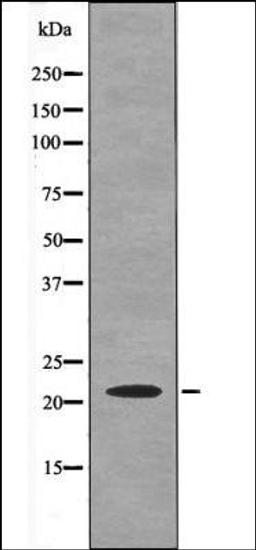 Western blot analysis of HeLa whole cell lysates using Claudin 1 -Phospho-Tyr210- antibody