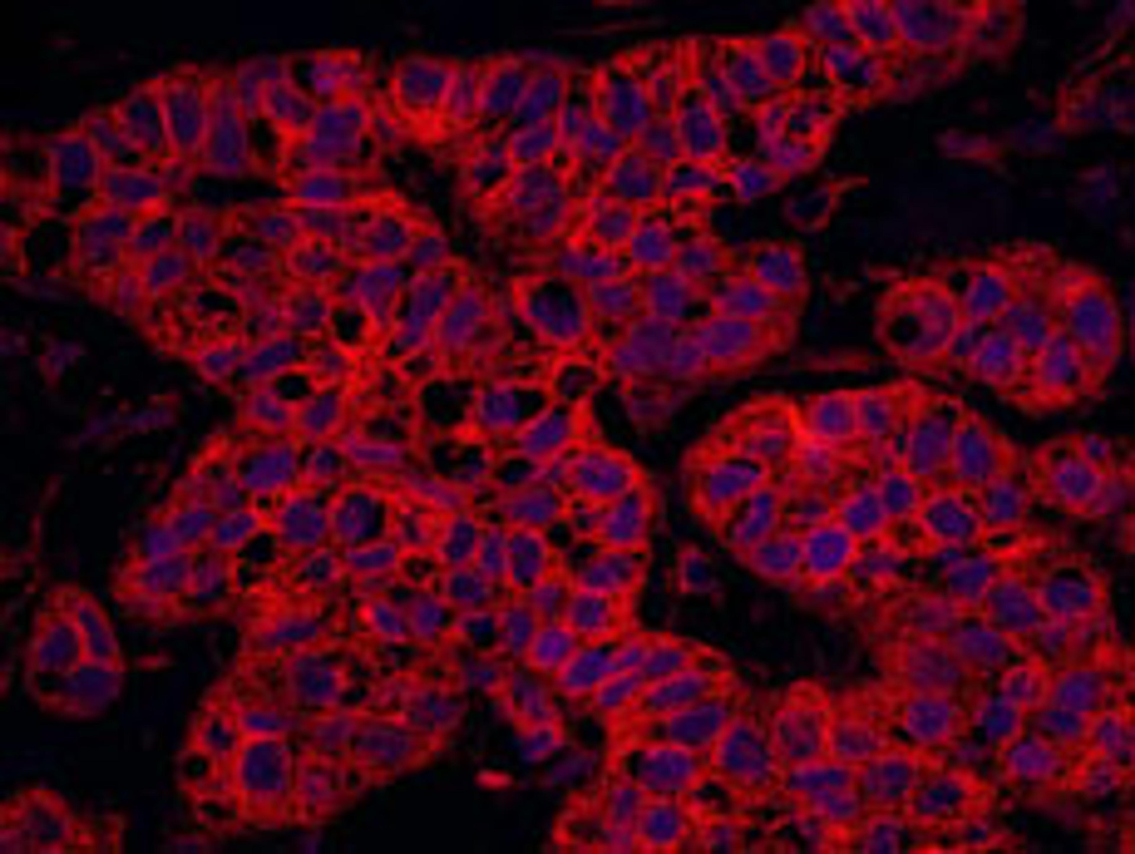 Detection of human Septin 9 by immunohistochemistry.