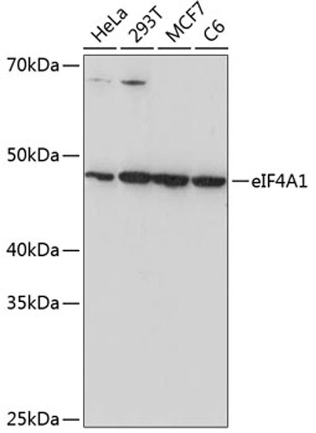 Western blot - eIF4A1 Rabbit mAb (A11584)