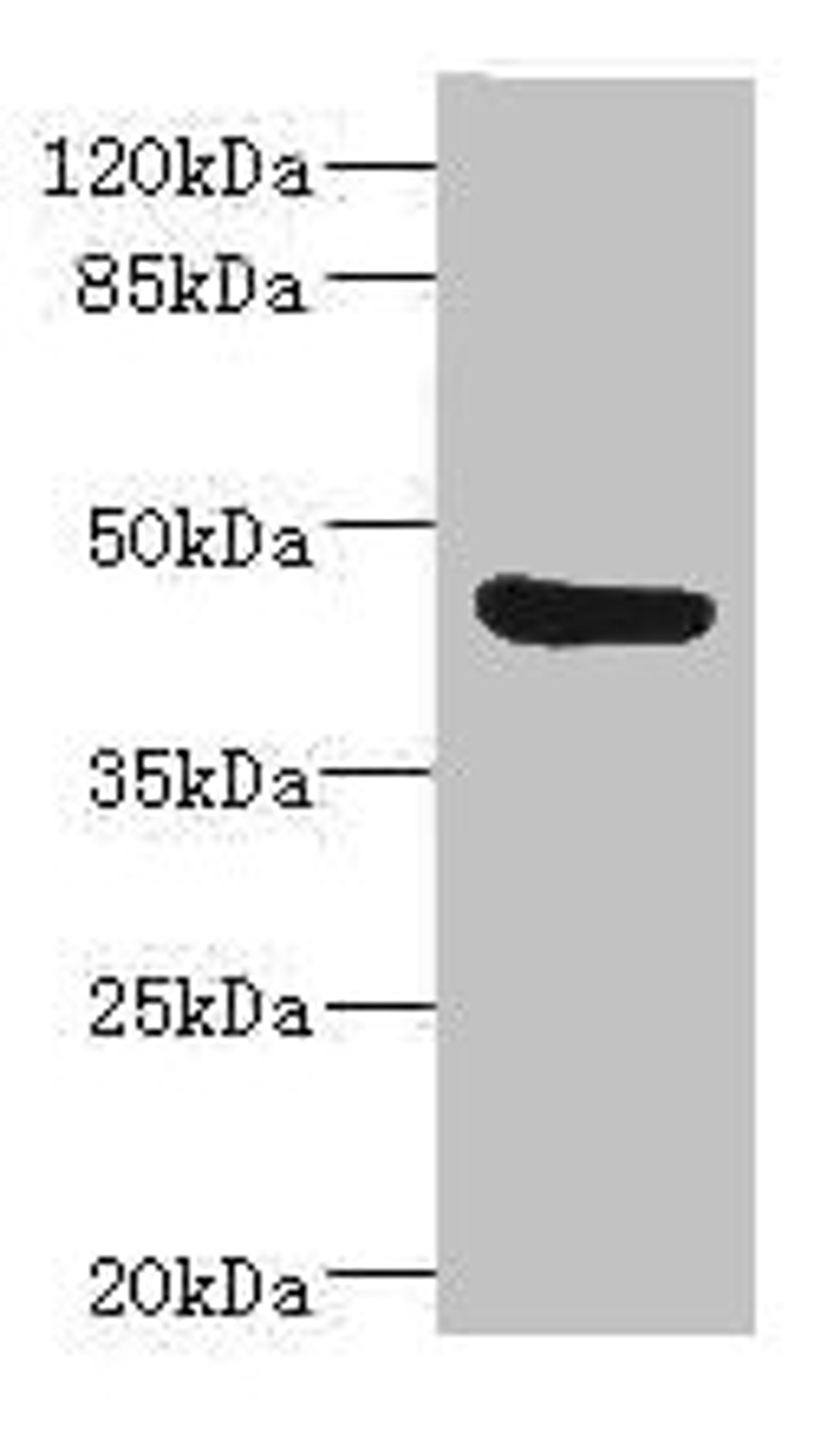 Western blot. All lanes: BAAT antibody IgG at 3.73ug/ml + Mouse liver tissue. Secondary. Goat polyclonal to rabbit IgG at 1/10000 dilution. Predicted band size: 46 kDa. Observed band size: 46 kDa. 