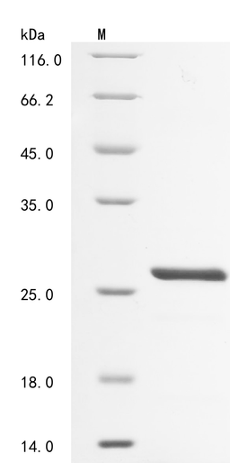 (Tris-Glycine gel) Discontinuous SDS-PAGE (reduced) with 5% enrichment gel and 15% separation gel.