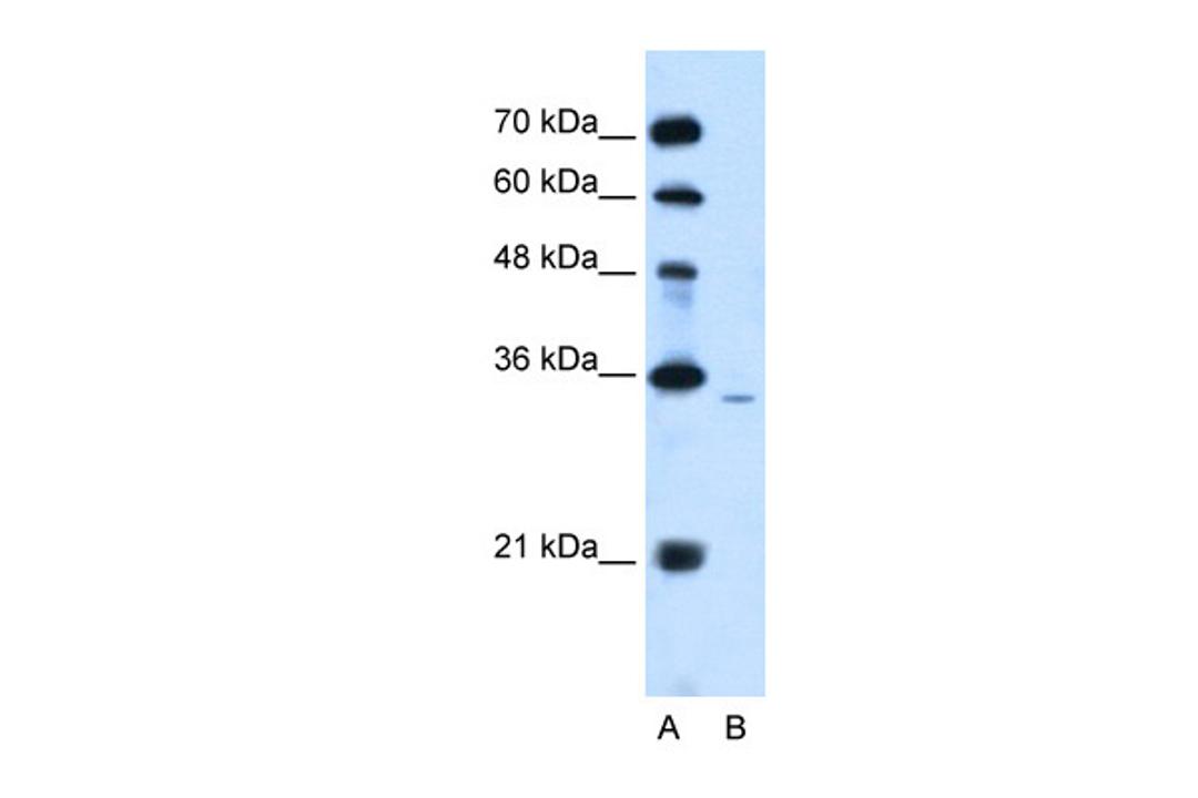 Antibody used in WB on Human Jurkat 2.5 ug/ml.