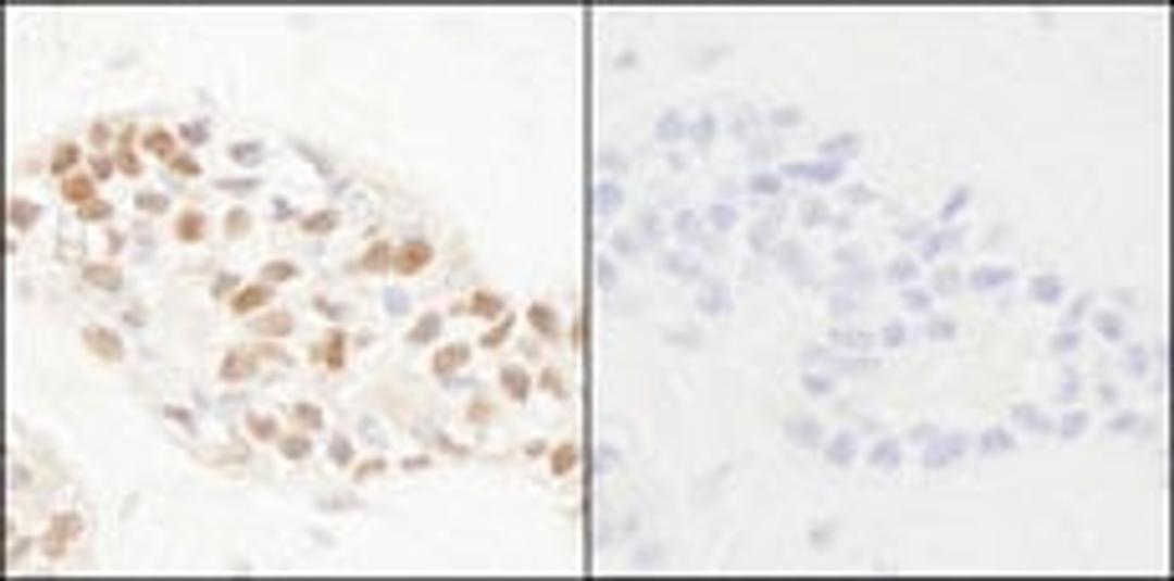 Detection of human Phospho-PCNA (Y211) by immunohistochemistry.