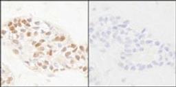 Detection of human Phospho-PCNA (Y211) by immunohistochemistry.