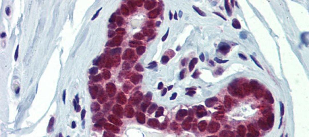 Antibody used in IHC on Human Breast at 5.0 ug/ml.