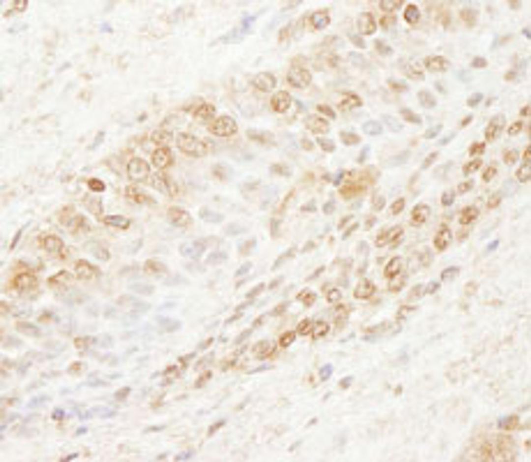 Detection of human WDR91 by immunohistochemistry.