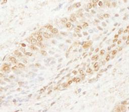 Detection of human WDR91 by immunohistochemistry.