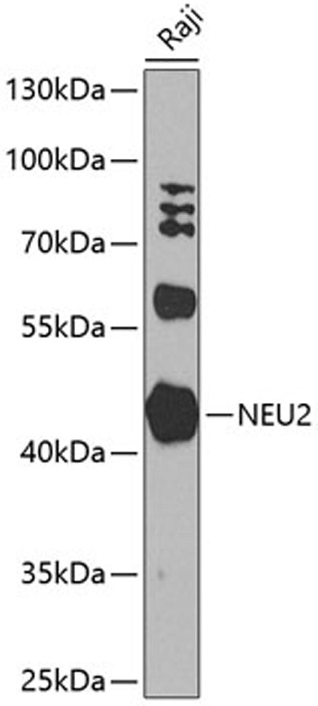 Western blot - NEU2 antibody (A8137)