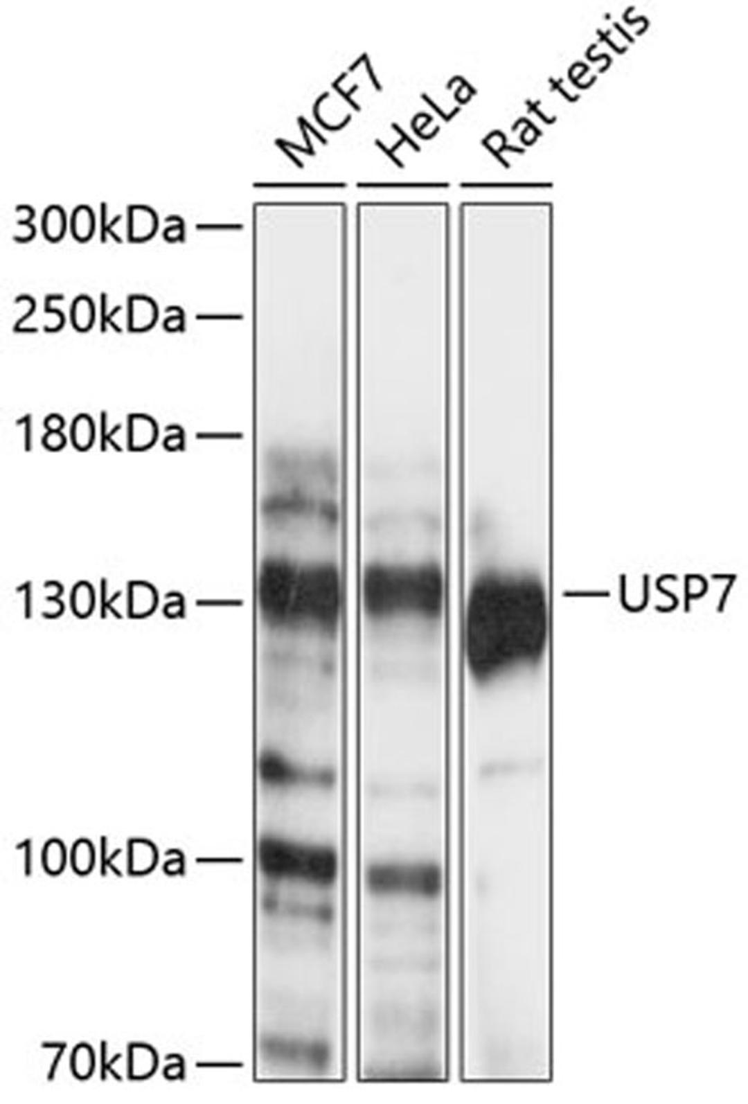 Western blot - USP7 antibody (A13565)