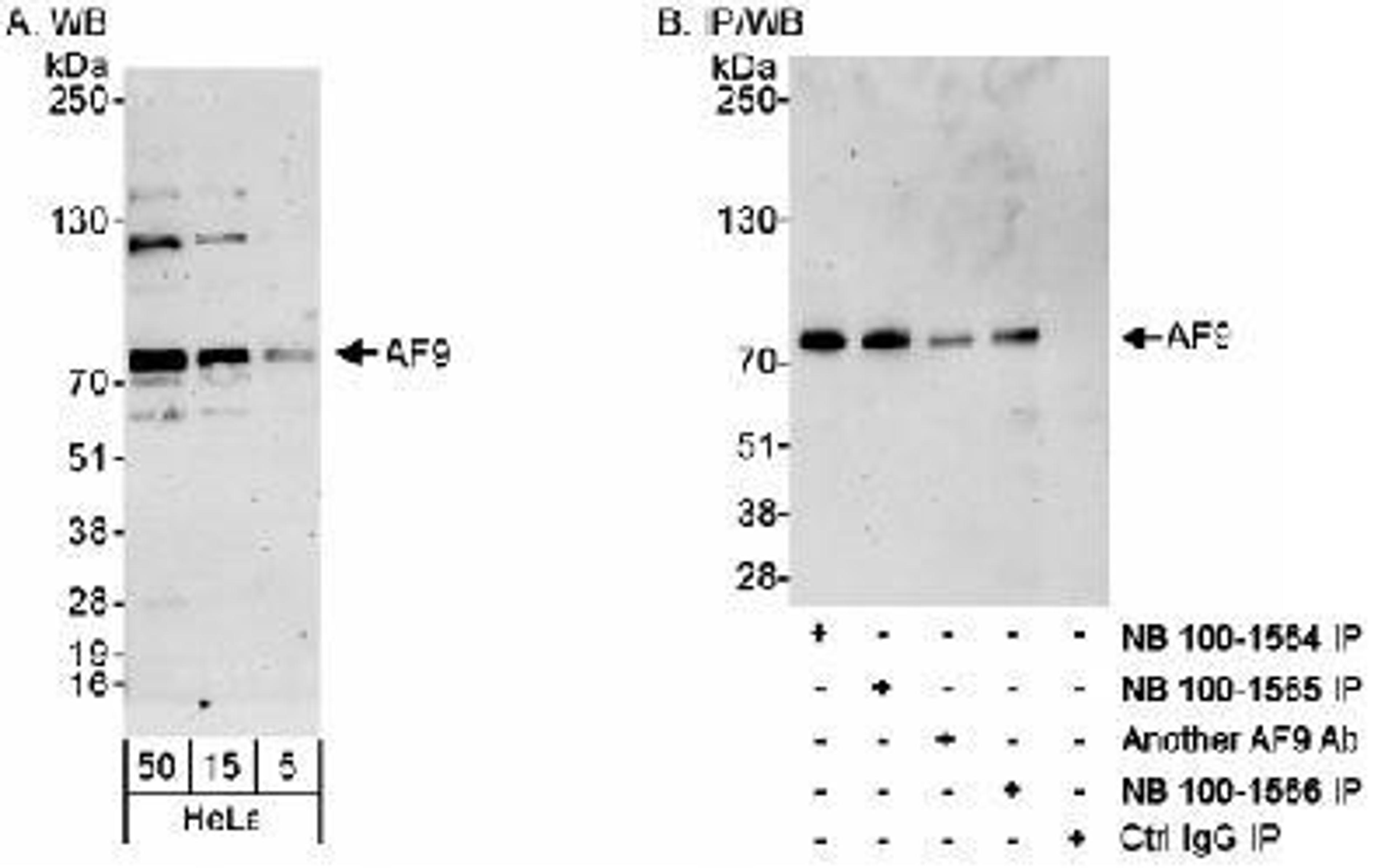 Western Blot: AF9 Antibody [NB100-1566] - Detection of Human AF9 on HeLa whole cell lysates using NB100-1566. AF9 was also immunoprecipitated using rabbit anti-AF9 antibodies NB100-1564, NB100-1565 and another AF9 Ab.