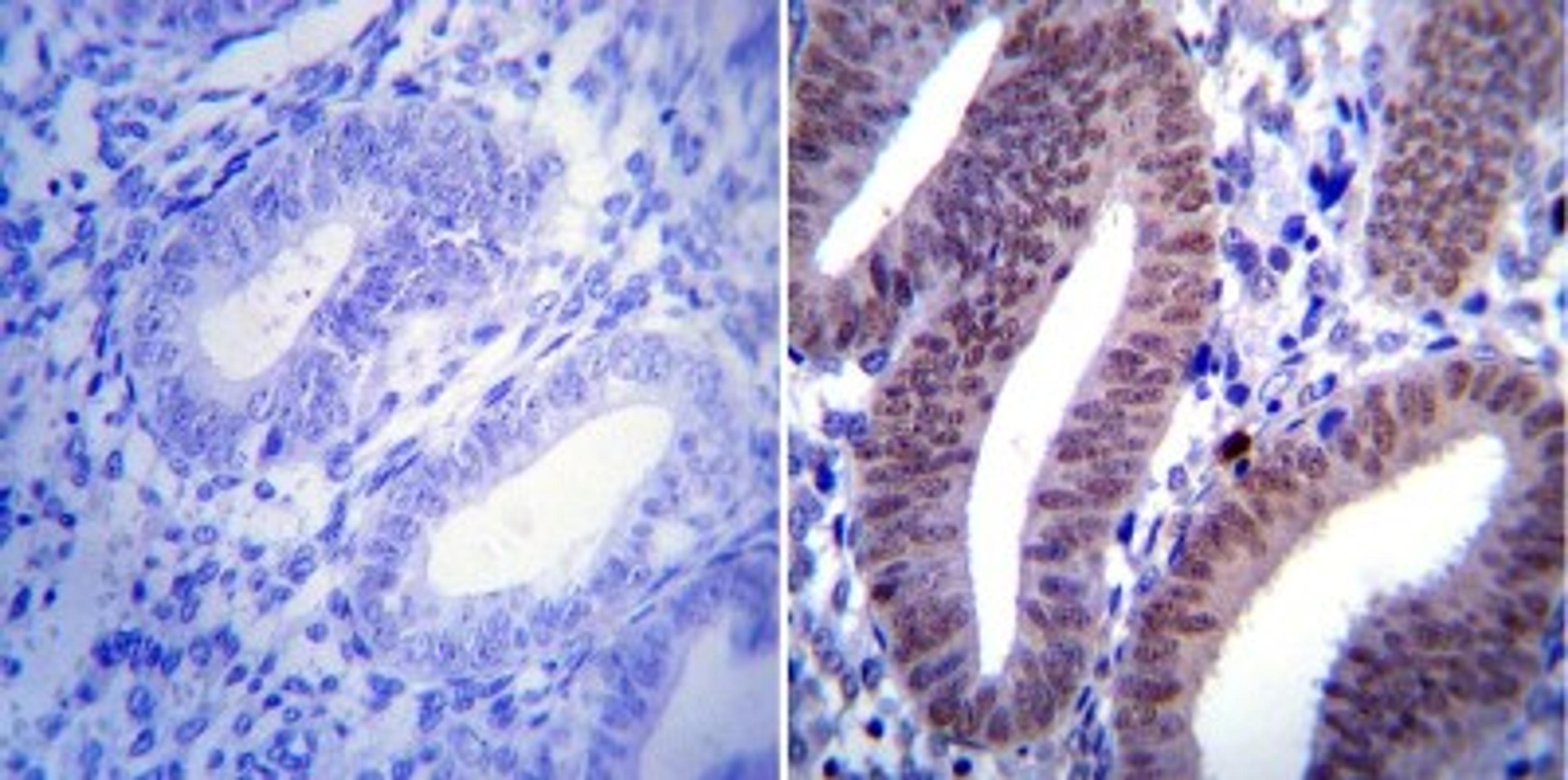 Immunohistochemistry-Paraffin: Progesterone R/NR3C3 Antibody (Alpha PR6) [NB120-2765] - Staining of human uterus tissue.