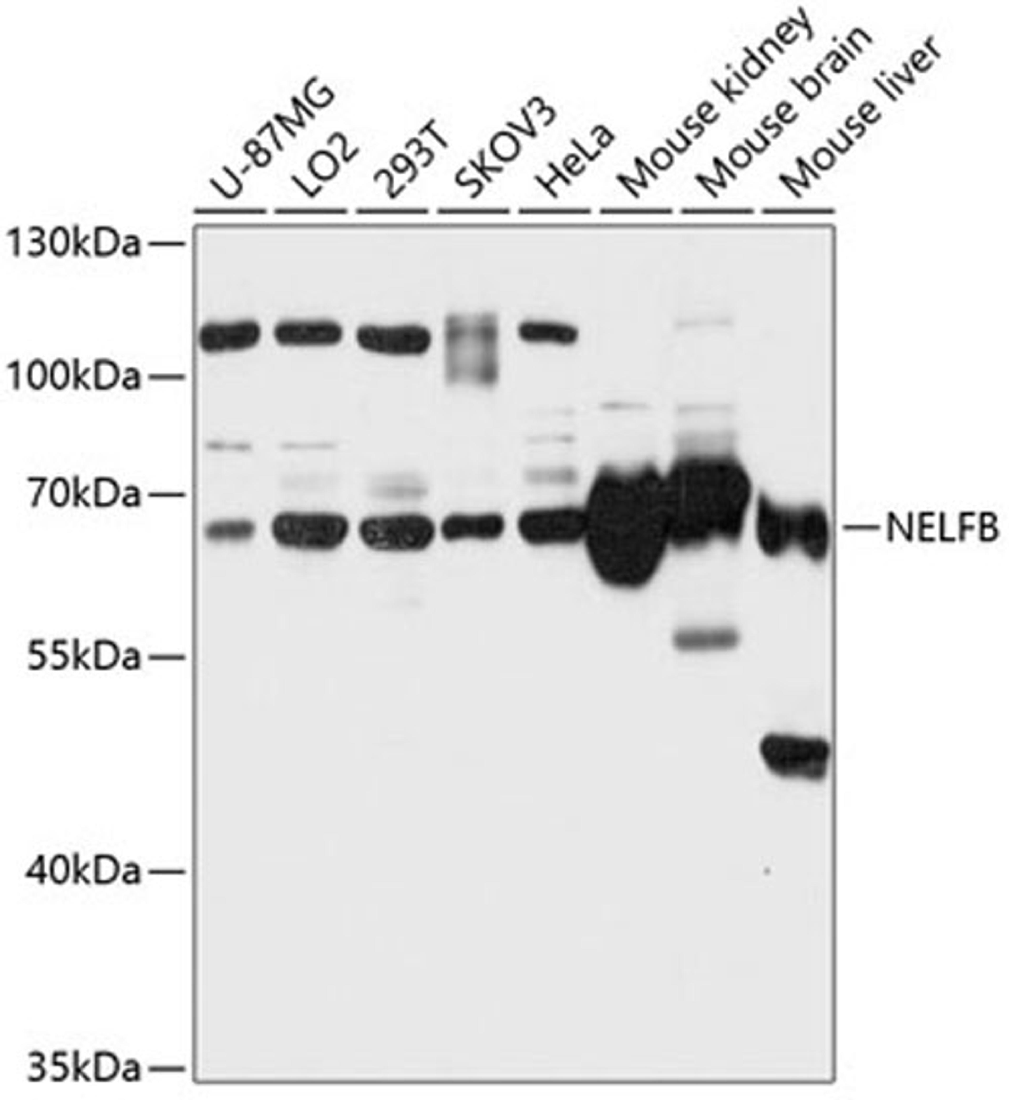 Western blot - NELFB antibody (A12023)