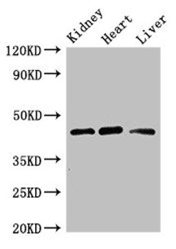 Western Blot. Positive WB detected in: Mouse kidney tissue, Rat heart tissue, Rat liver tissue. All lanes: WTAP antibody at 3ug/ml. Secondary. Goat polyclonal to rabbit IgG at 1/50000 dilution. Predicted band size: 45, 18 kDa. Observed band size: 45 kDa. 
