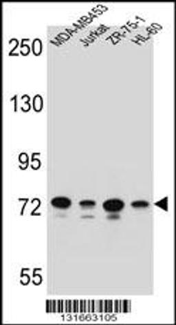 Western blot analysis in MDA-MB453,Jurkat,ZR-75-1,HL-60 cell line lysates (35ug/lane).