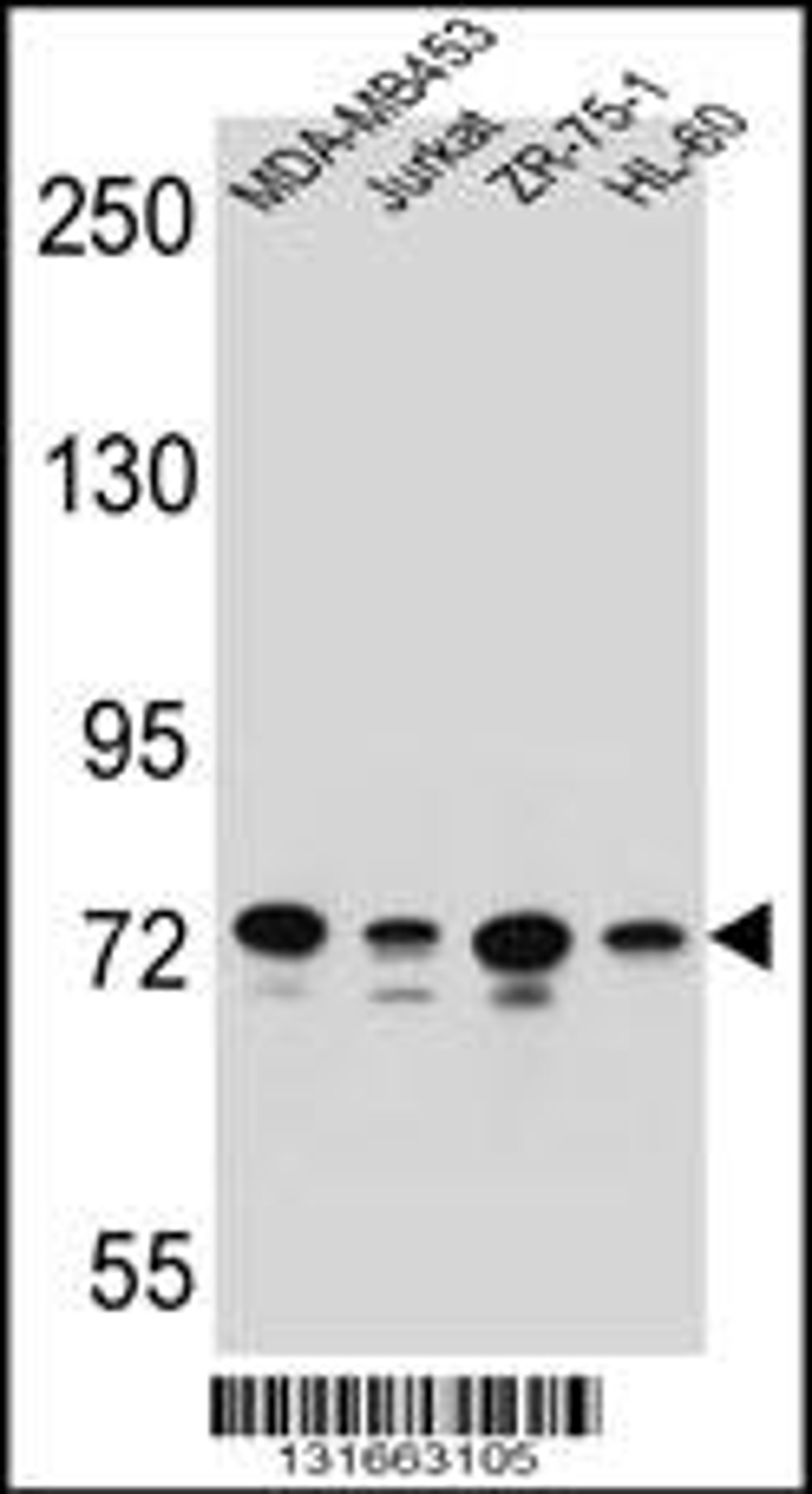 Western blot analysis in MDA-MB453,Jurkat,ZR-75-1,HL-60 cell line lysates (35ug/lane).