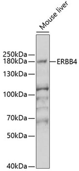 Western blot - ERBB4 antibody (A6133)