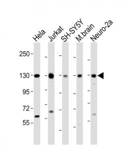 Western Blot at 1:2000 dilution Lane 1: Hela whole cell lysate Lane 2: Jurkat whole cell lysate Lane 3: SH-SY5Y whole cell lysate Lane 4: mouse brain lysate Lane 5: Neuro-2a whole cell lysate Lysates/proteins at 20 ug per lane.