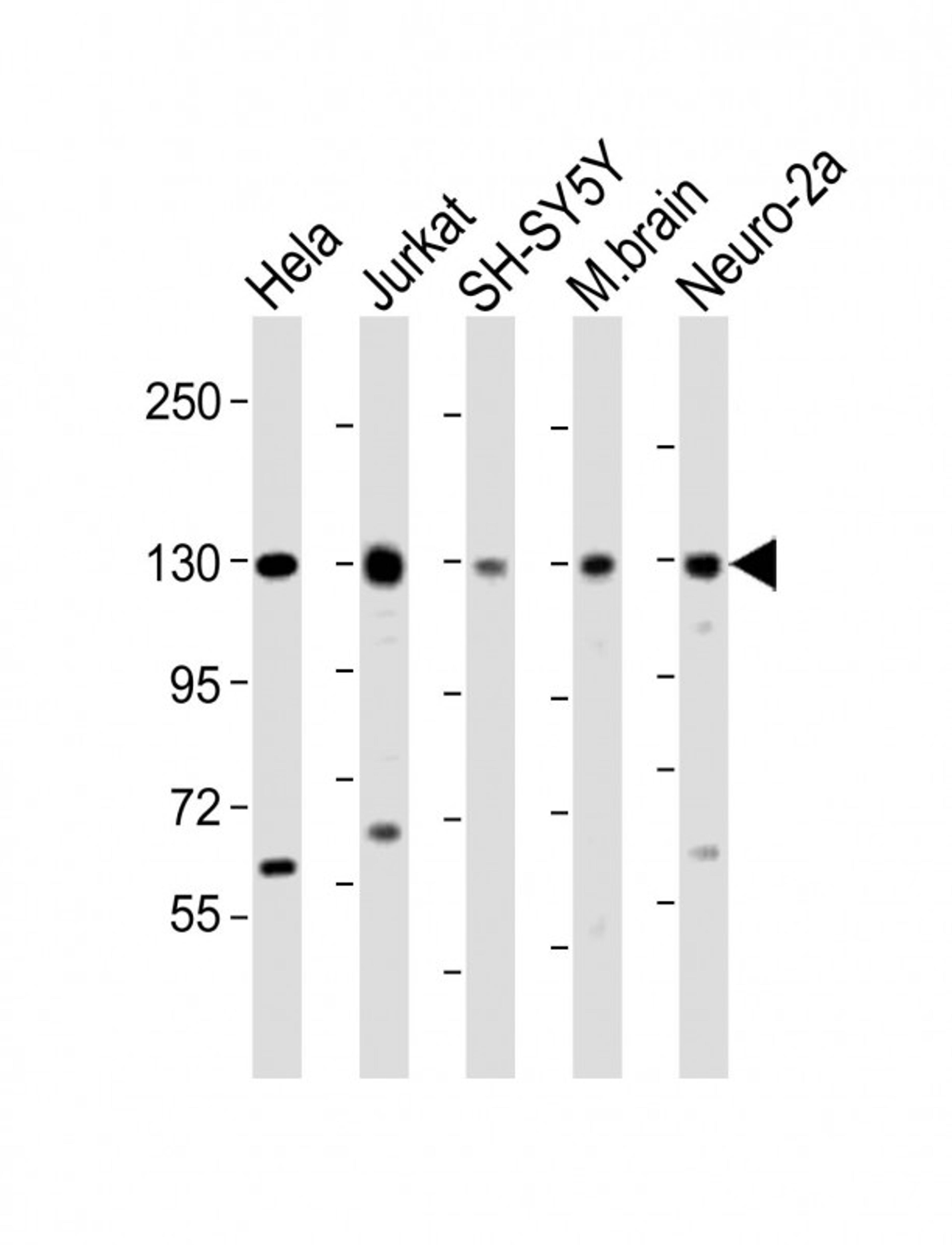 Western Blot at 1:2000 dilution Lane 1: Hela whole cell lysate Lane 2: Jurkat whole cell lysate Lane 3: SH-SY5Y whole cell lysate Lane 4: mouse brain lysate Lane 5: Neuro-2a whole cell lysate Lysates/proteins at 20 ug per lane.