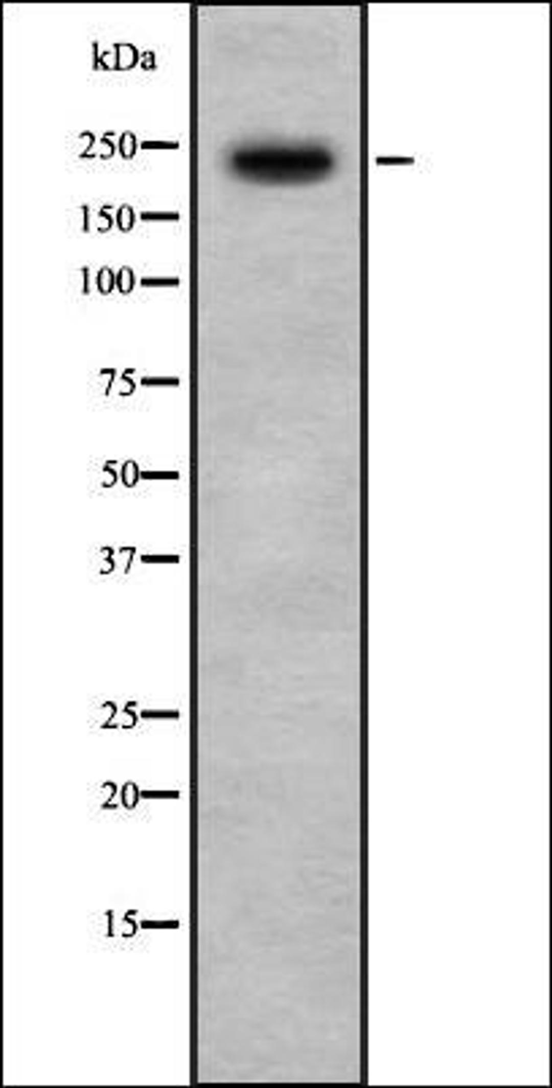 Western blot analysis of HeLa whole cell lysates using PHF3 antibody