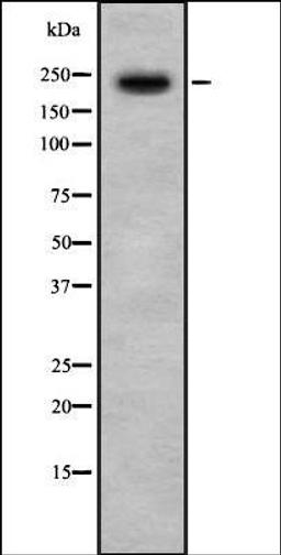 Western blot analysis of HeLa whole cell lysates using PHF3 antibody