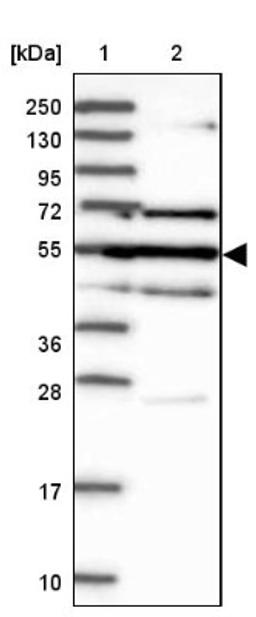 Western Blot: GAL3ST4 Antibody [NBP1-82309] - Lane 1: Marker [kDa] 250, 130, 95, 72, 55, 36, 28, 17, 10<br/>Lane 2: Human cell line RT-4