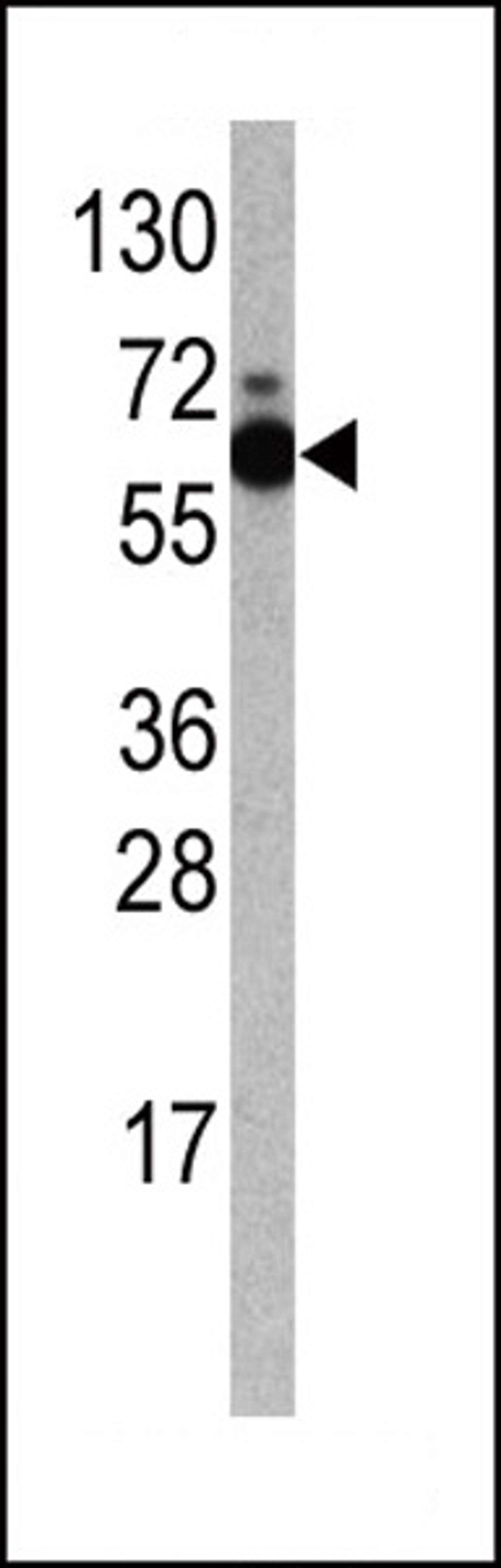 Western blot analysis of anti-RPS6KB1 Antibody Pab in Jurkat cell line lysates (35ug/lane).