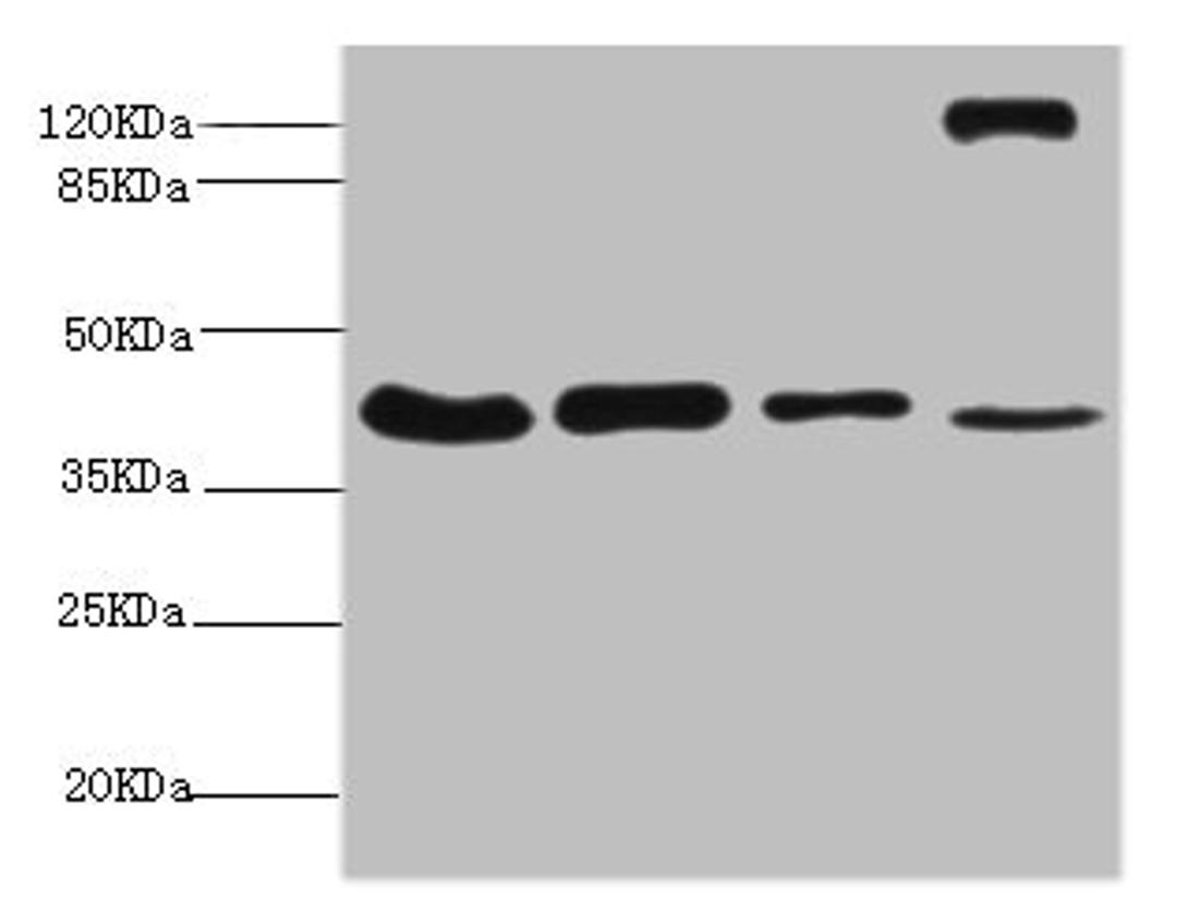 Western blot. All lanes: NSFL1C antibody at 6.3ug/ml. Lane 1: Mouse brain tissue. Lane 2: A431 whole cell lysate. Lane 3: 293T whole cell lysate. Lane 4: Rat liver tissue. Secondary. Goat polyclonal to rabbit IgG at 1/10000 dilution. Predicted band size: 41, 38, 29 kDa. Observed band size: 41, 130 kDa. 