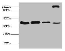 Western blot. All lanes: NSFL1C antibody at 6.3ug/ml. Lane 1: Mouse brain tissue. Lane 2: A431 whole cell lysate. Lane 3: 293T whole cell lysate. Lane 4: Rat liver tissue. Secondary. Goat polyclonal to rabbit IgG at 1/10000 dilution. Predicted band size: 41, 38, 29 kDa. Observed band size: 41, 130 kDa. 